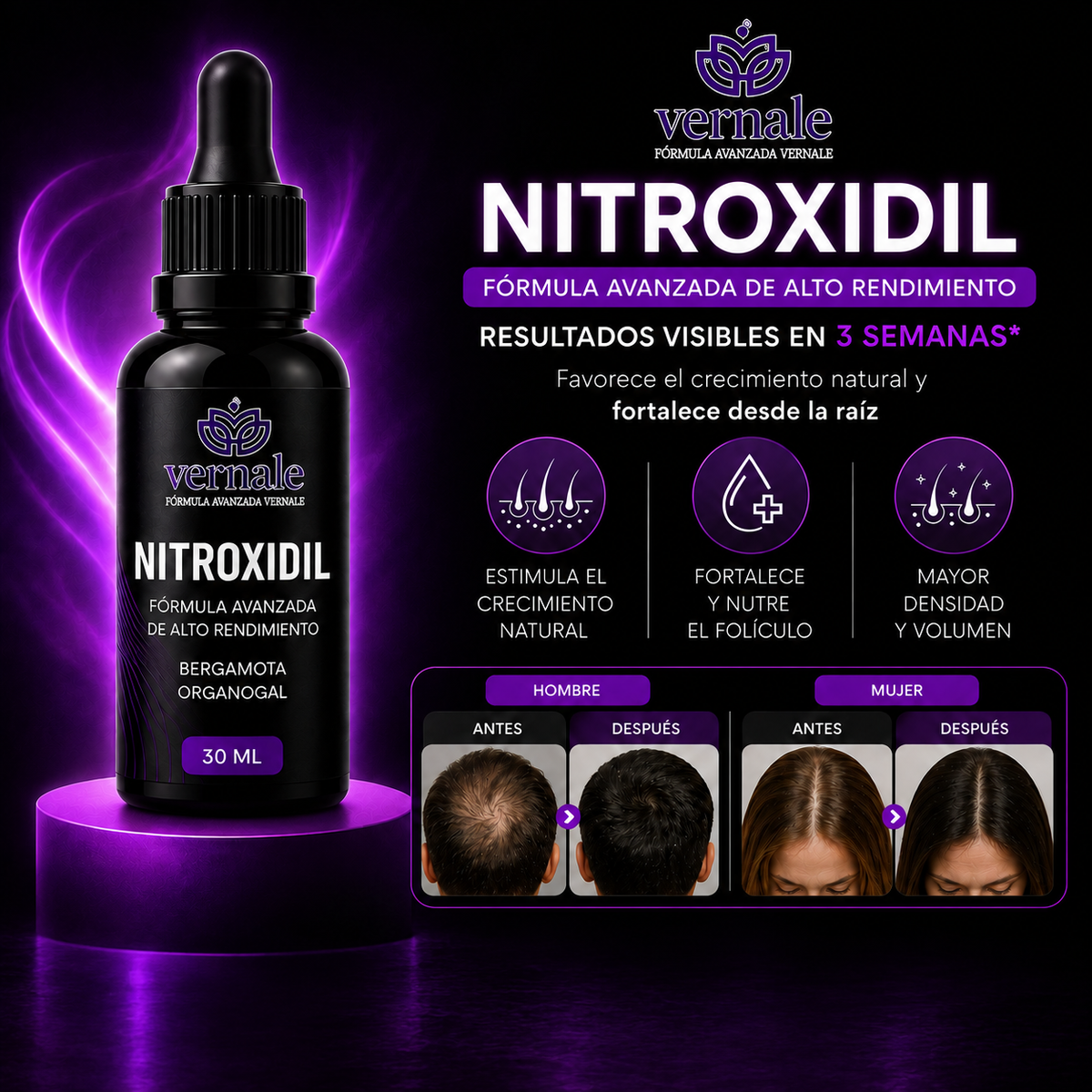 Nitroxidil