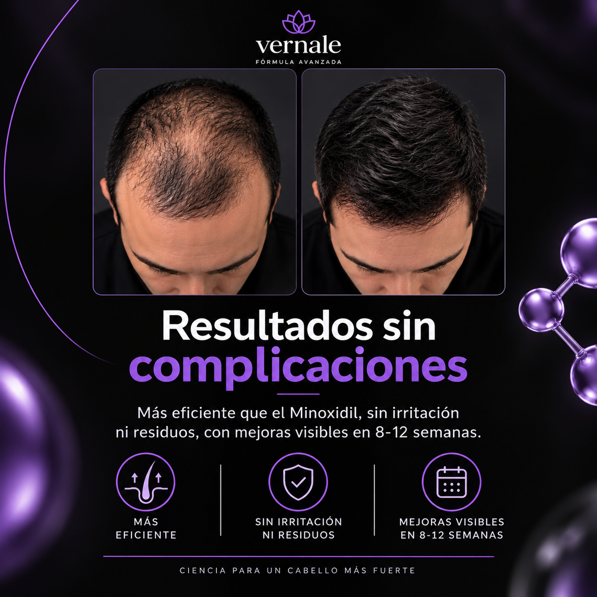 Nitroxidil