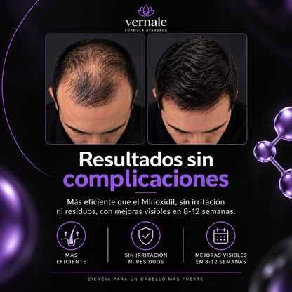Nitroxidil